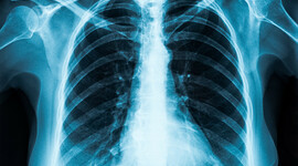 Timeline: PRESABERES Y FUNDAMENTOS