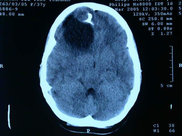 primera imagen tomografica