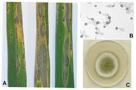 LA TEORIA MICROBIANA