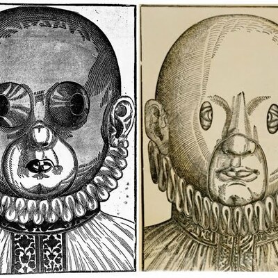 Timeline: Historia de la ortóptica. Dr. John Atencion Sanchez, presentado por Andrea Hernández Rizo (ortóptica y pleoptica)