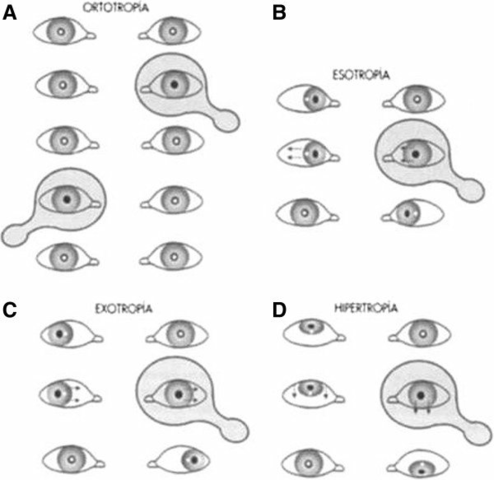 1828-1870 AlbrechtVon Graefe