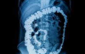 Aplicaciones desde 1895 hasta nuestros días de la radiación ionizante