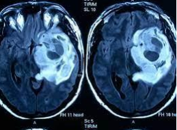 Aplicaciones desde 1895 hasta nuestros días de la radiación ionizante