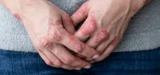 Efectos biológicos de la radiación