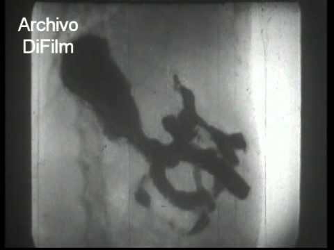 Película con Rayos X