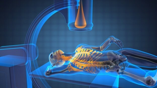 Aplicación de la gammagrafía