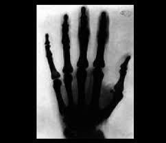 Efectos Biológicos de la radiación evento 4