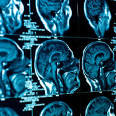 Timeline:  Historia de la Neurología (Maria Jose Arias Cruz)