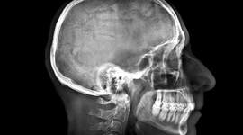 Timeline: RADIOBIOLOGIA Y RADIOPROTECCION.