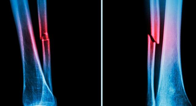 Comité internacional de protección radiológica