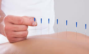 Medicina Tradicional China (Incluye Acupuntura)