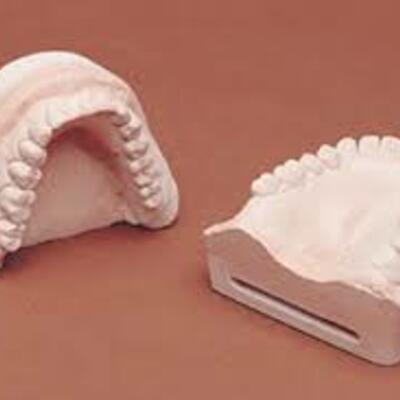 Timeline: Línea del Tiempo de la Historia de los Materiales Dentales