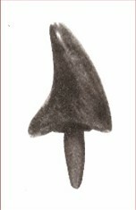 Año 1603: Prótesis de madera