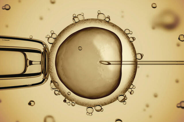la inseminación artificial