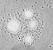 Secuenciación del genoma de Legionella pneumophila