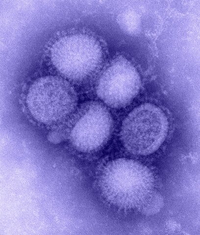 Caracterización "in vivo" e "in vitro" del virus H1N1.