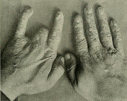 Mihran Kassabian dies