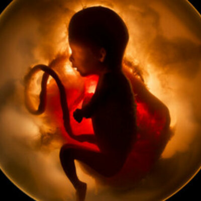 Timeline: Línea del tiempo desarrollo prenatal. - Por José Edén Martínez Bojórquez