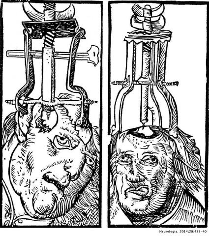 NEOLÍTICO- EDAD DE HIERRO