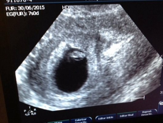 Comienza a latir el corazón