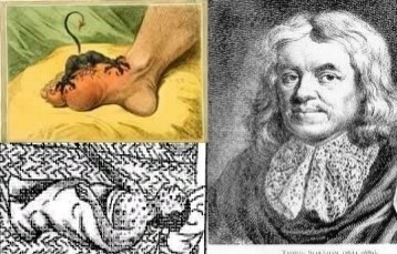 Aprendiendo a contar: la estadística sanitaria