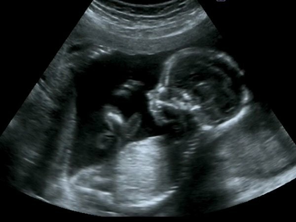 El feto ya es capaz de tragar, digerir y orinar el líquido amniotico