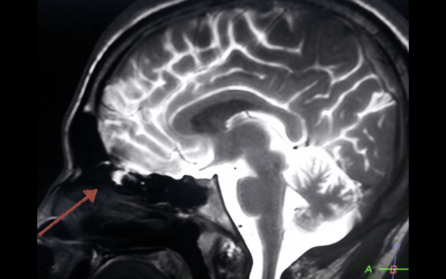 Primera descripción completa del LCR