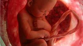 Timeline: Desarrollo Neuro Embrionario