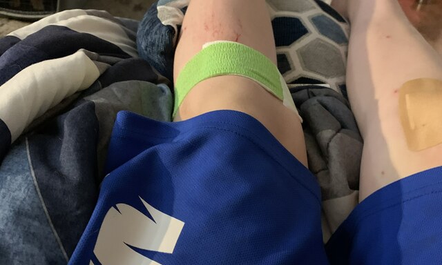 When my knees got cut open from falling and sliding on shattered glass and rocks.