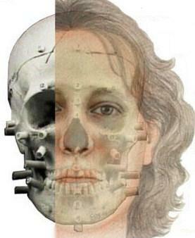 Antropología Criminal.