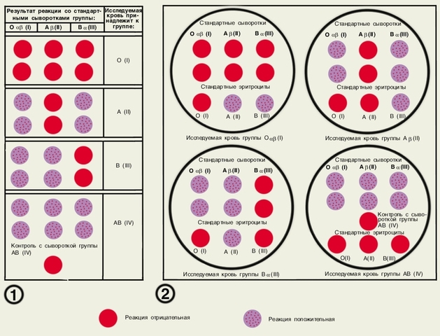 Ландштейнер открыл группы крови, начало переливания крови