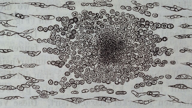 Virchow completa la teoría celular