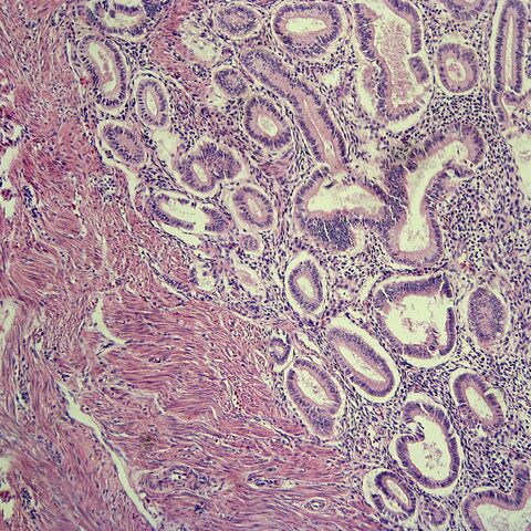 Blastocyst going through implantation