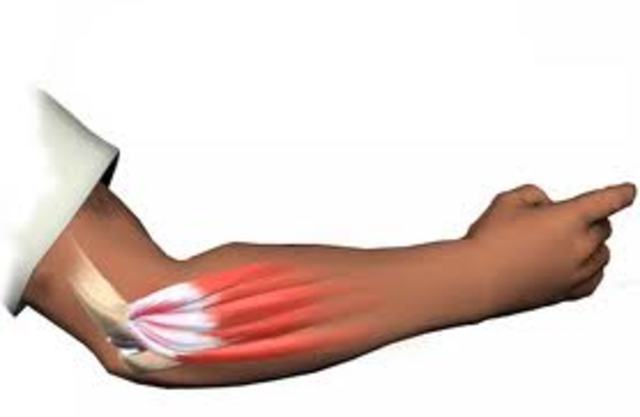 EL primer donk del mundo con codo