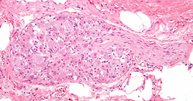 Ganglios Cerebroespinales