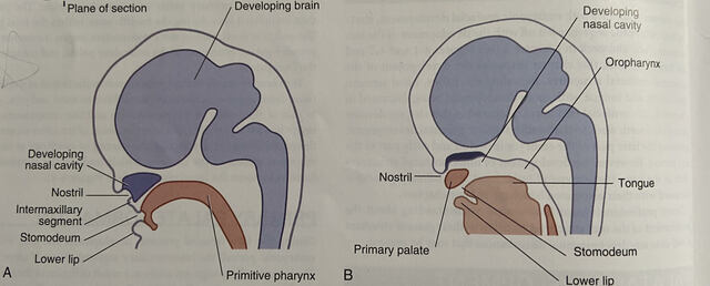 Intermaxillary Segment