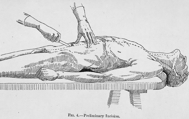 Surgimiento de la Ciencia Forense