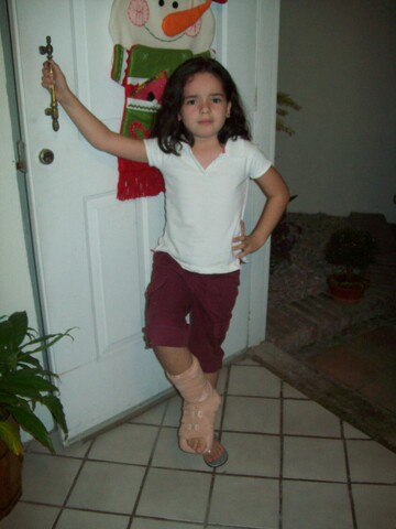 Mi primer hueso roto