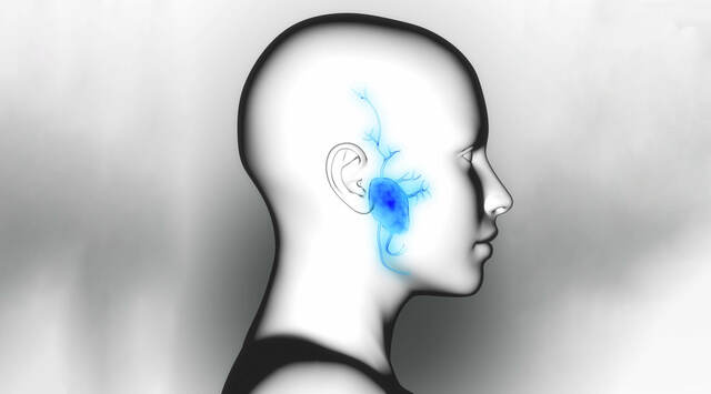 Sigmund Freud, Tumor