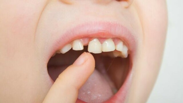 Erori zitzaidan lehenengo hortza