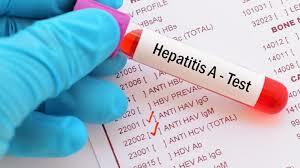 VACUNA HEPATITIS A