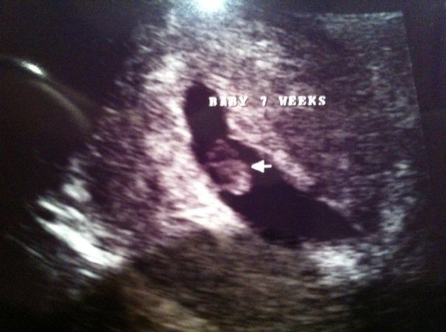 The day that my family was shocked.