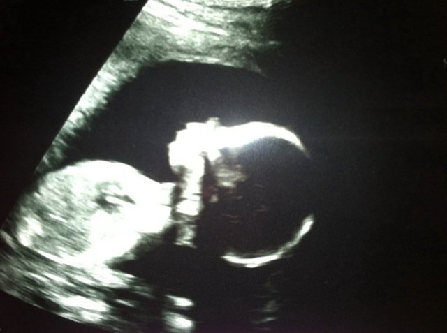 The day my family found out that it was a girl.