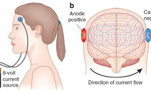 Corriente galvánica para estimulación cerebral por Luigi Rolando