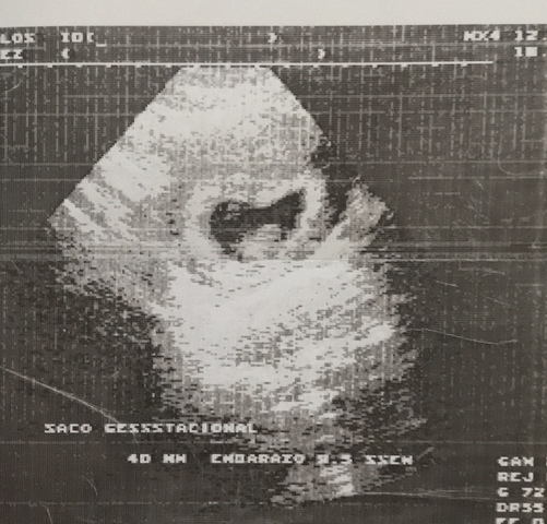 Mi mamá embarazada de mi