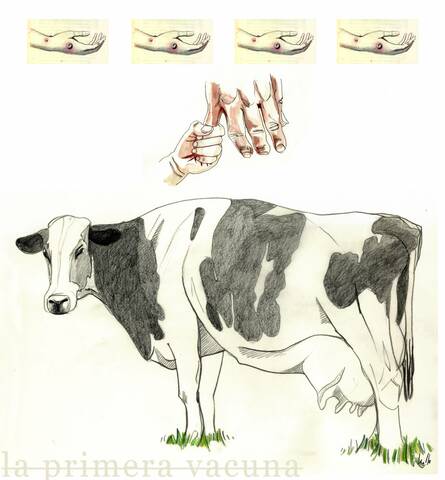 Edward Jenner desarrolla la primera vacuna contra la viruela humana