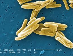 Robert Koch descubre el Mycobacterium tuberculosis