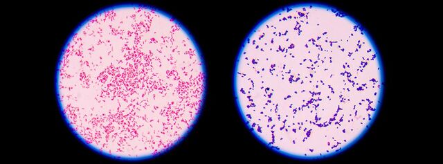 Desarrollo de la tinción de Gram