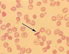 The first crystal test for hemoglobin