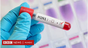 H1N1